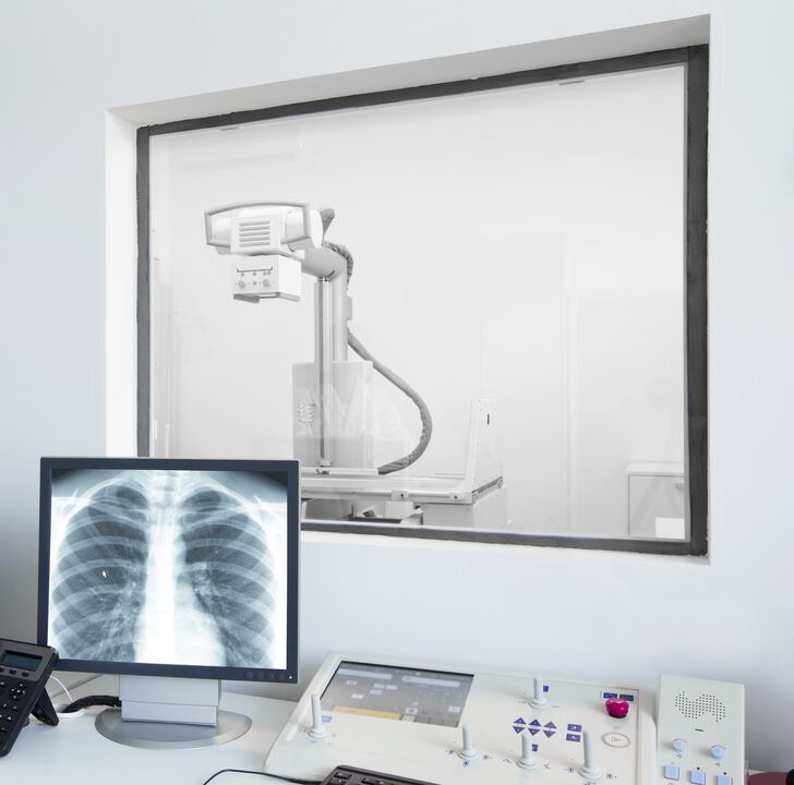 Gerinc röntgen - az osteochondrosis diagnosztizálásának fő módszere