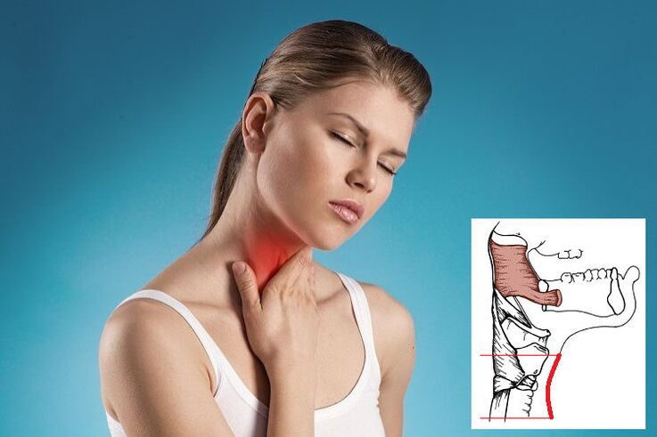 Torokfájás nyaki osteochondrosissal az idegek összenyomódása miatt