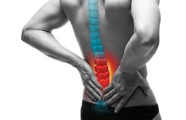 Az osteochondrosis a gerinc betegsége