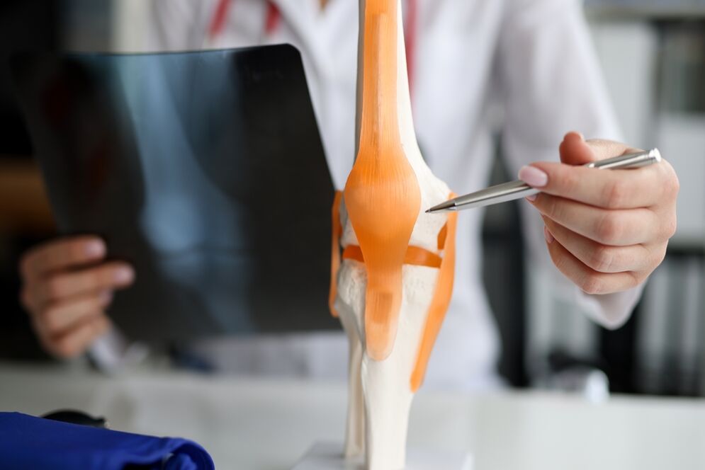 Olyan ízület bemutatása, amelyben a degeneratív változások arthrosis kialakulásához vezetnek