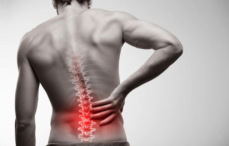 alsó hátfájás osteochondrosis miatt