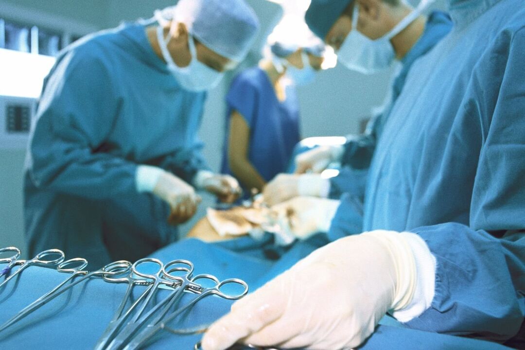 az osteochondrosis sebészeti kezelése